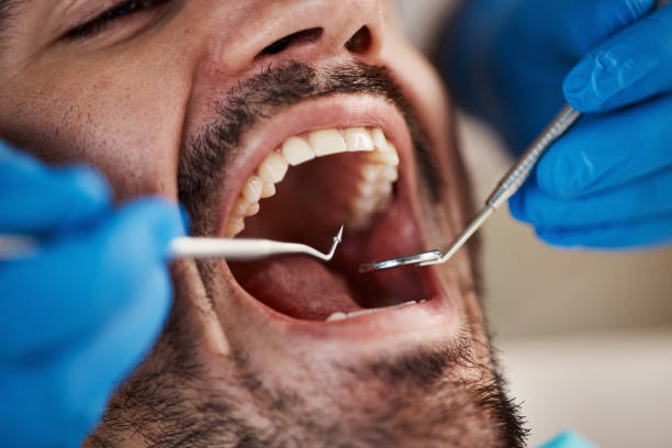Best Dental Abscess Treatment in South Lake Tahoe, CA